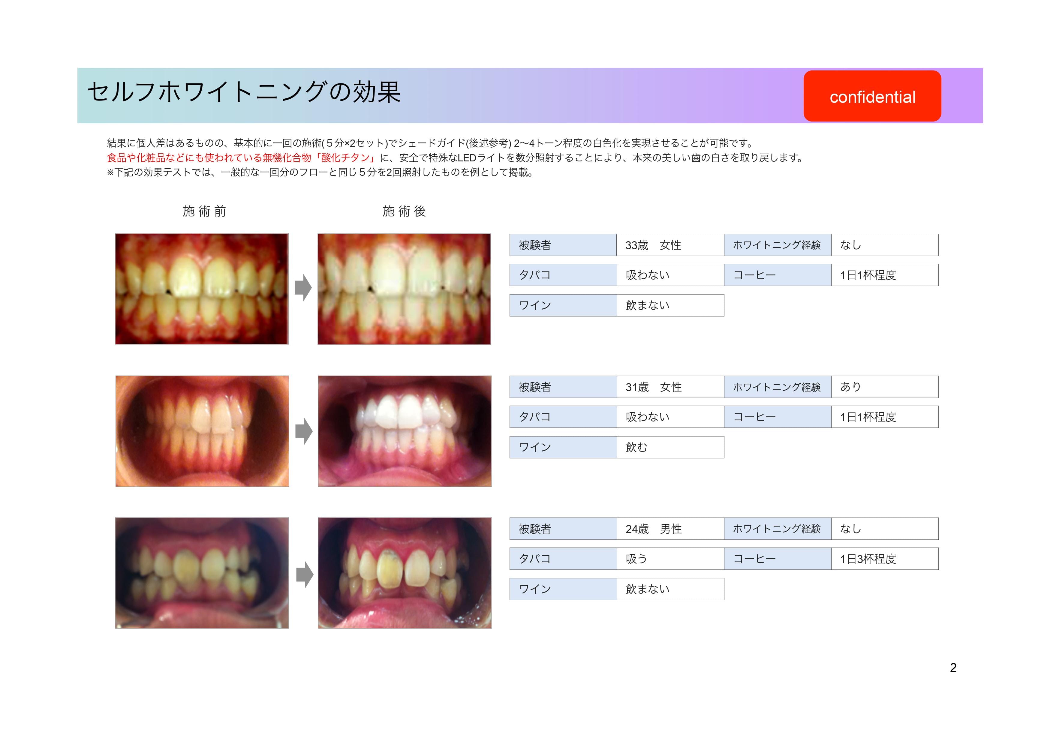 before,afterの画像